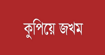 গাজীপুরে ইজারাদারকে কুপিয়ে জখম ,মামলা হলেও আসামি ধরছেনা পুলিশ – Daily Gazipur Online